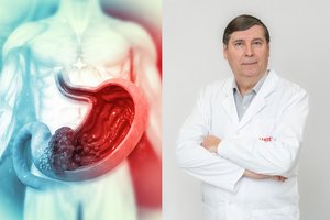 Paplitusi bakterija gali sukelti skrandžio vėžį: pajutus šiuos simptomus delsti negalima