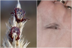 Būkite atidūs: jau fiksuojamos prabudusios erkės