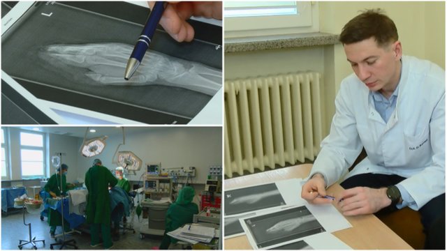 Kauno medikai atliko itin retą operaciją: jaunuoliui netekus plaštakos pirštų, rado sprendimą