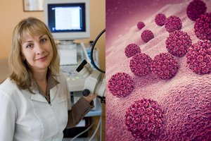 Išskirtinis vėžys, kuriam užkirsti kelią galima, kol liga dar neišsivystė: ragina suklusti visas moteris