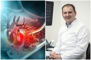 Netipiniai simptomai išduoda širdies ligas: kardiologas atsakė, į ką atkreipti dėmesį