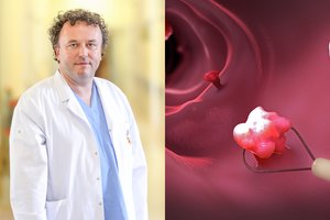 Tai sukliudo vėžio išsivystymui: atsakė, kam priklauso nemokamas tyrimas