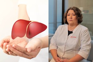 Niežulys ir pykinimas – kepenų ligų ženklai: gydytoja atskleidė, kurie žmonės turėtų išsitirti