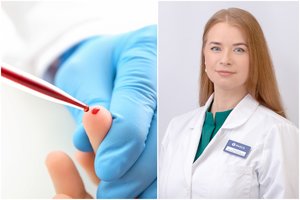 Šeimos gydytoja pasakė, kokį lobį pacientai praranda dėl nežinojimo: svarbūs tyrimai – nemokami