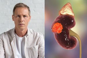 Inkstų vėžį įveikęs vilnietis atviras – gyvybę išgelbėjęs gydytojos pasiūlymas iš pradžių suerzino