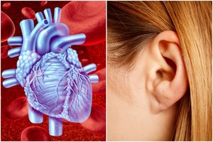 Širdies ligos pavojų išduoda įlinkimas ausyje: skubiai pasitikrinkite