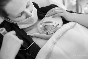 „Ankstukai“ startuoja: anksčiau laiko gimusių kūdikių problemą atkleis simboliška iniciatyva