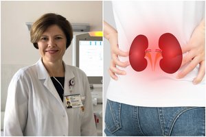 Troškulys, patinimai ir niežulys – inkstų ligos pranašai: profesorė įspėjo, kokiems žmonėms gresia susirgti