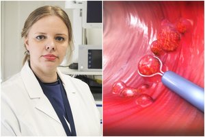 Ypač klastingas vėžys dažnai neturi simptomų: tuos, kurie myli gyvenimą, kviečia pasitikrinti nemokamai