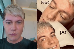 Karolis Murauskas išbandė ilgalaikio makiažo procedūrą