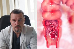 Gydytojas išvardijo Lietuvoje dažno vėžio simptomus: delsti jau nebegalima