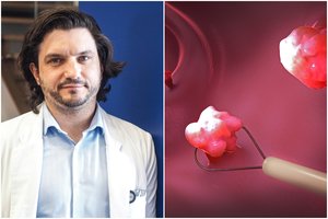 Klastingu vėžiu vis dažniau serga net jauni žmonės: išvardijo pirmus ligos simptomus