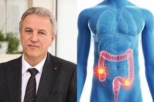 Daugeliui šis vėžys nustatomas, kai jau būna stipriai pažengęs: atsakė, kaip ligą užčiuopti laiku