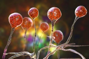 Pirmasis toks atvejis pasaulyje – vyras susirgo augalams būdinga liga: simptomai priminė gripą