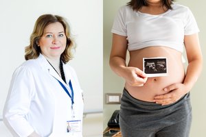 Moters sveikata nėštumo pradžioje: gydytoja išvardijo, ką reikia žinoti