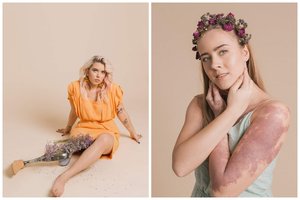 Modelis be kojos ar neįgaliojo vežimėlyje? Taip, prašom!