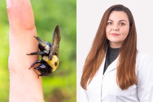 Šeimos gydytoja patarė, kaip elgtis įkandus vabzdžiui: bus ramu, kad į organizmą pateks mažiau nuodų