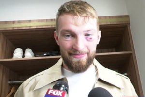 Domantas Sabonis su pamušta akimi po mačo San Fransiske atrodė kaip ištrūkęs iš mišrių kovos menų narvo
