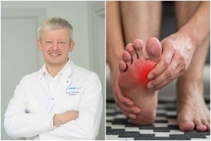 Gydytojas įspėjo dėl pėdos skausmo: savaime nepraeis, bus tik blogiau