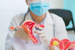 Kiaušidžių vėžys: kas turėtų išsitirti dėl šios patologijos?