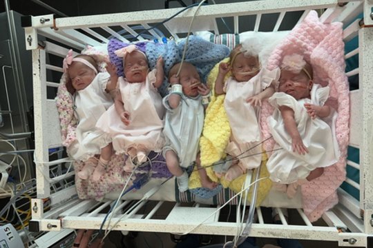 Misisipėje gimęs penketukas yra dar retesnis nei įprastai vien dėl vienos ypatingos savybės