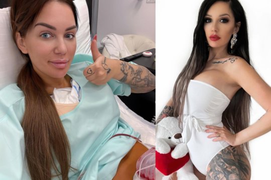 Justina Partikė ryžosi dar vienai operacijai: „Buvo ryškiai persistengta“