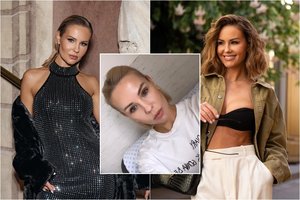 I. Burlinskaitė prakalbo apie pirmuosius klastingos ligos simptomus: „Net ir kraujo tyrimas gali neparodyti, kad tu sergi tokia sunkia liga“