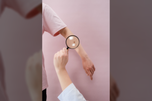 Odos vėžiu susirgęs Aurimas: viskas prasidėjo nuo žaizdelės pakaušyje