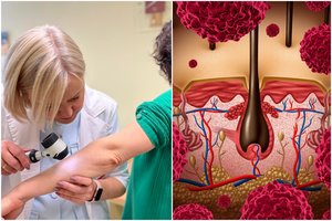 Po sveikatos patikrų Klaipėdoje – šiurpūs rezultatai: klastingu vėžiu suserga vis jaunesni