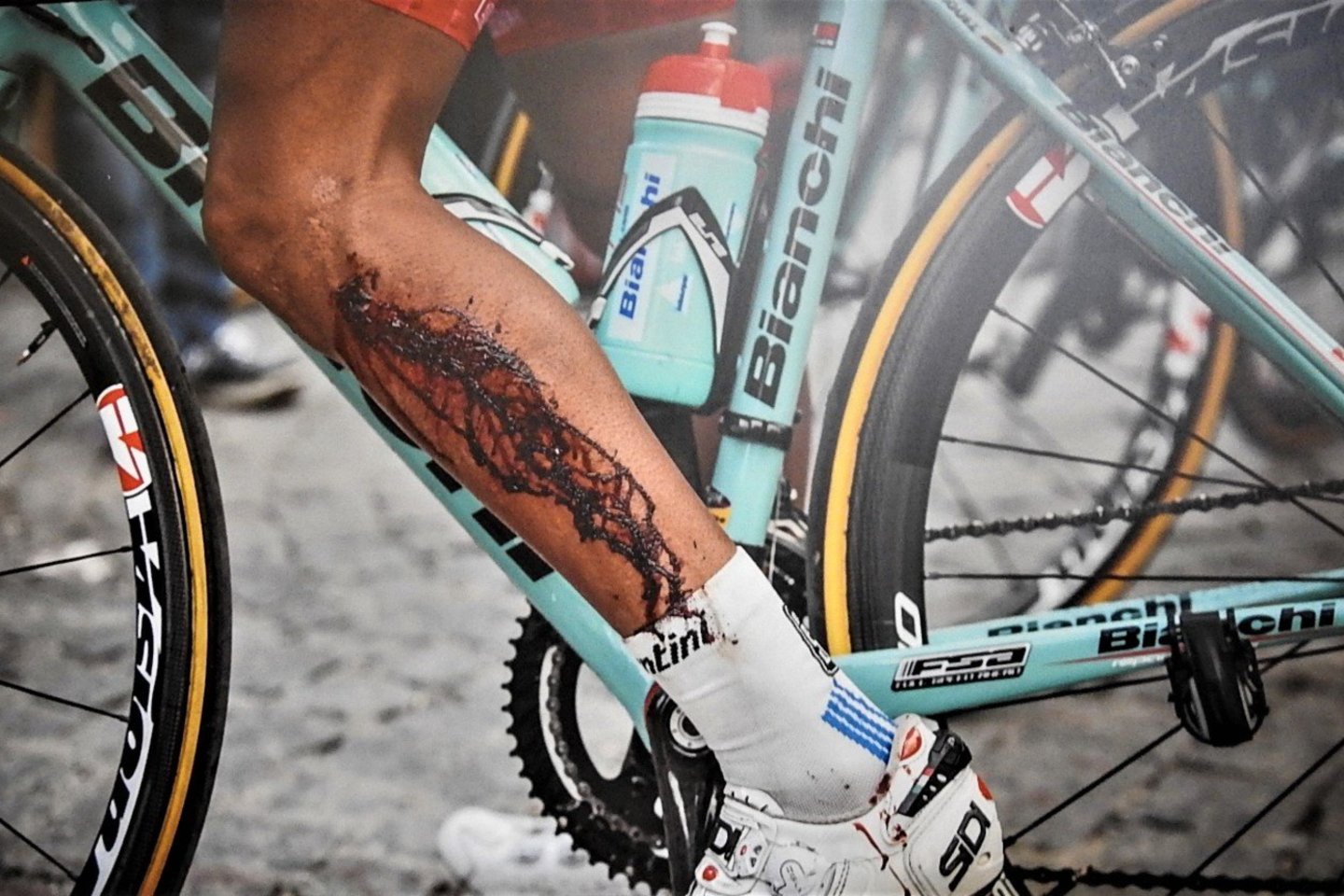  "Giro d'Italia": pergalės anatomija.<br> G.Beržinsko nuotr.