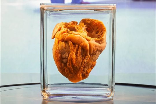 Moteris, kuriai 22 metų buvo persodinta širdis, aplankė savo senąją širdį, dabar eksponuojamą Hunteriano muziejuje Londone.