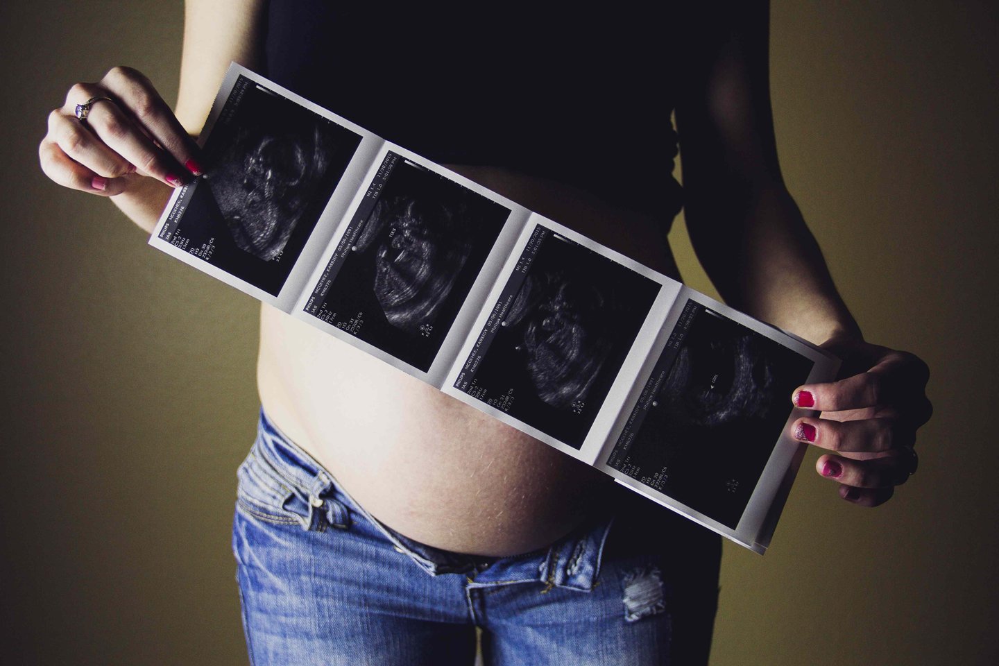 Įvairių klausimų turi ne tik planuojančios nėštumą, bet ir pastojusios moterys, o ypač tos, kurios pastojo neplanuotai – žinant atsakymus į dažniausius klausimus nėštumo laikotarpis gali praeiti daug sklandžiau, patiriant mažiau nerimo.<br> „Unsplash“ nuotr.