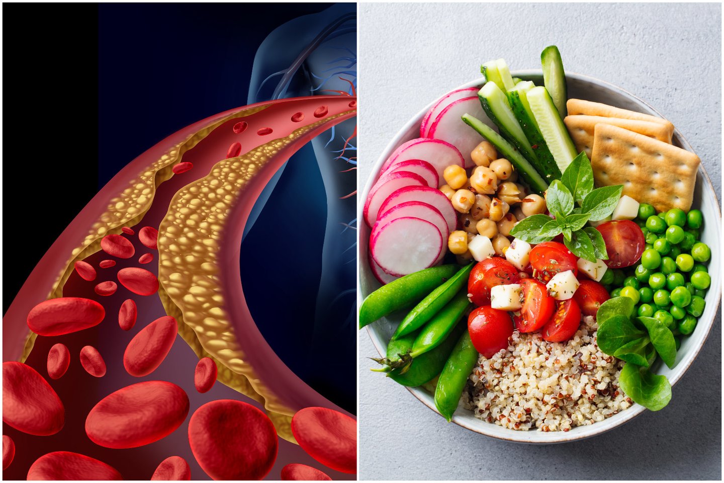 Vegetariška ir veganiška mityba gali sumažinti su maistu gaunamo cholesterolio kiekį.<br>lrytas.lt koliažas