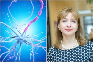 Neurologė įspėjo dėl ypač klastingos ligos: simptomai dažną suklaidina