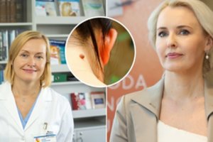 Vėžys vystosi, o skausmo nėra: gydytojai atsakė, kurie ženklai negali praslysti pro akis