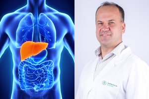 Įvardijo požymį, kuris išduoda – vystosi sunki kepenų liga