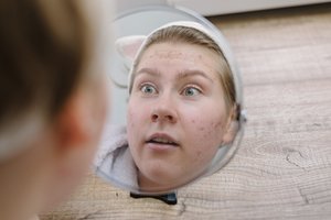 Skaidulų trūkumą gali išduoti ir tokie požymiai, apie kuriuos net nepagalvotumėte