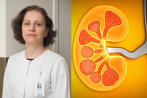 Klastingą vėžį išduoda 3 klasikiniai simptomai: juos pajutus – nevalia delsti