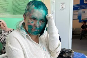 NVO: Čečėnijoje žiauriai sumušta Rusijos tiriamosios žurnalistikos reporterė