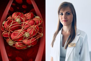 Kardiologė pasakė, kurie maisto produktai natūraliai skystina kraują ir neleidžia atsirasti krešuliams