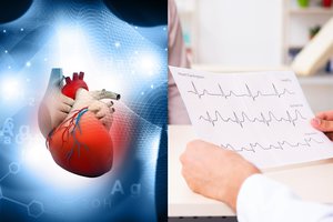 Prieširdžių virpėjimas gali neturėti simptomų: kardiologės patarimas padės atpažinti ligą