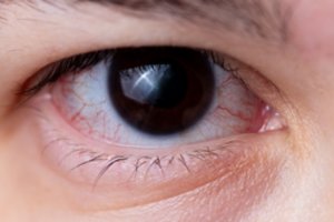 Gydytojus pribloškė radinys berniuko akyje – to išvysti nesitikėjo