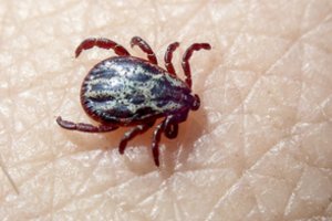 Pataria gydytojas: kaip saugiai ištraukti įsisiurbusią erkę