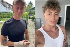 Palangoje sužalotas žinomas plaukų stilistas Ąžuolas Misiukevičius: „Eisiu iki galo“