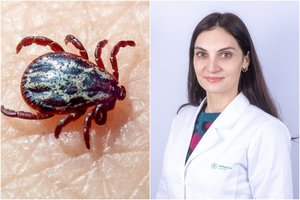 Įkando erkė? Stebėkite, ar neatsirado šie simptomai