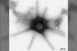 JAV aptikti milžiniški ir unikalūs virusai