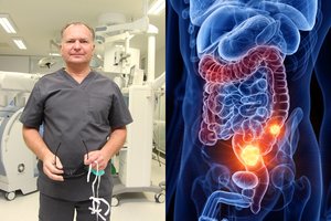 Nemokamas tyrimas gelbėja gyvybes: tai sutrukdo išsivystyti vėžiui