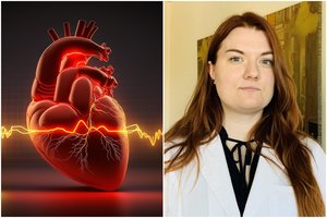 Kardiologė: galvos svaigimas ir silpnumas – pirmieji širdies ligos ženklai