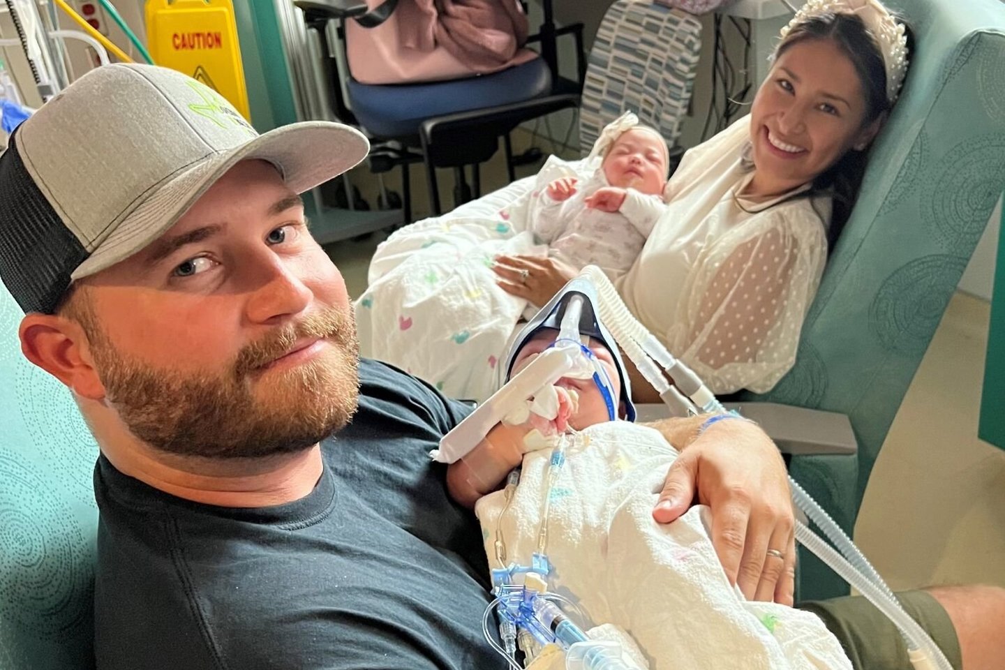  Siamo dvynės buvo suaugusios kepenimis ir pilvu.<br> Teksaso vaikų ligoninės nuotr.