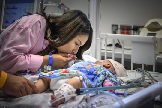   Siamo dvynės buvo suaugusios kepenimis ir pilvu.